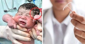 bébé avec un stérilet