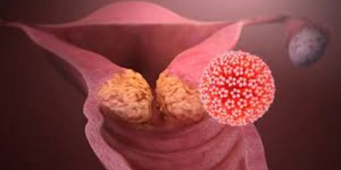 Virus du Papillome Humain HPV